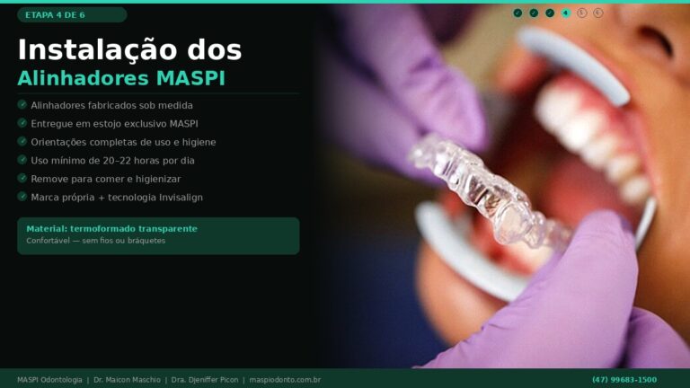 Instalação dos alinhadores invisíveis na MASPI Odonto