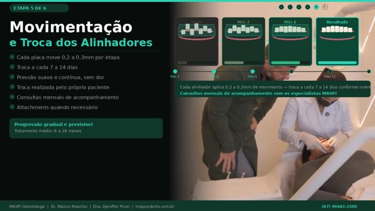 Movimentação dentária com alinhadores invisíveis em Balneário Camboriú