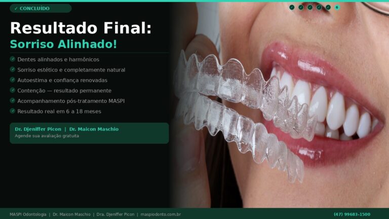 Resultado final do tratamento com alinhadores invisíveis - MASPI Odonto